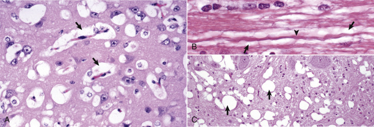 Figure 14-27