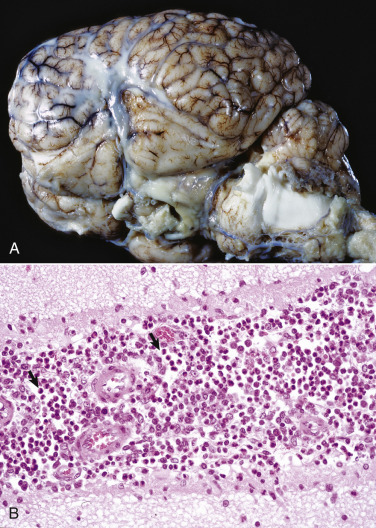 Figure 14-43