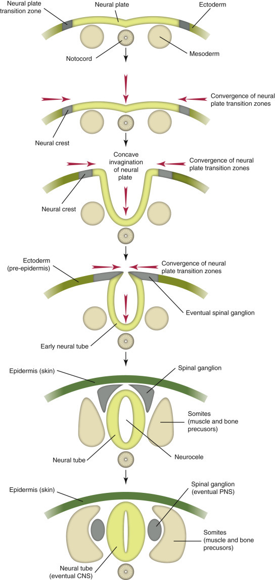 E-Figure 14-1