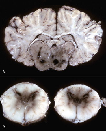 Figure 14-79