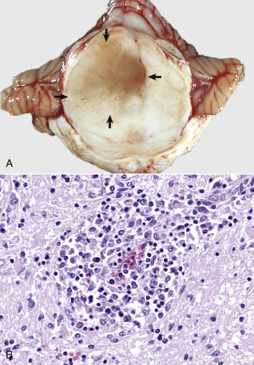 Figure 14-103