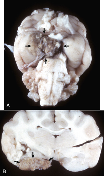 Figure 14-105