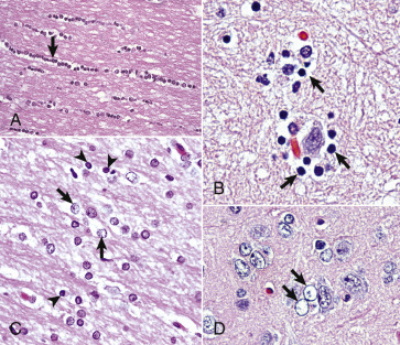 Figure 14-10