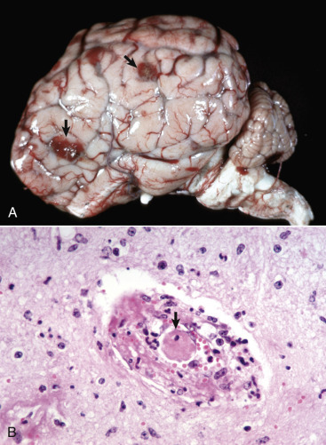 Figure 14-89