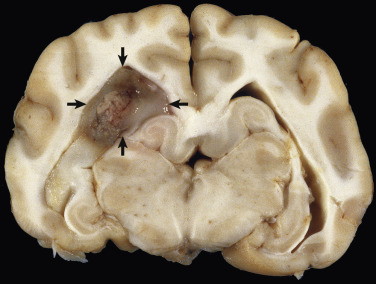 E-Figure 14-8