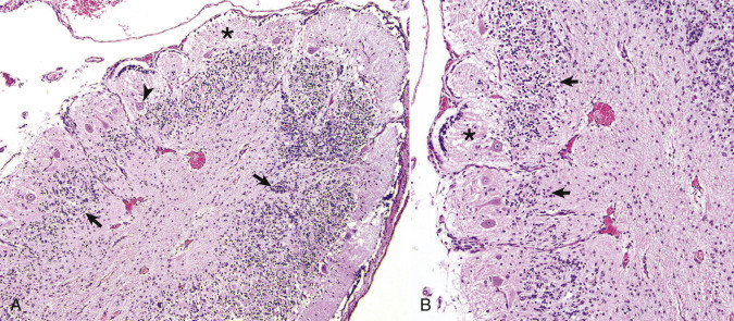 E-Figure 14-6