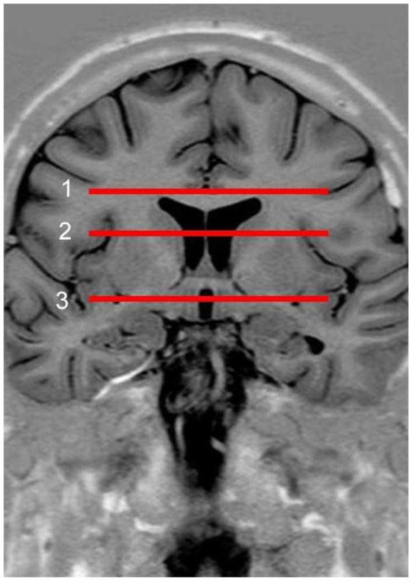 Fig 1