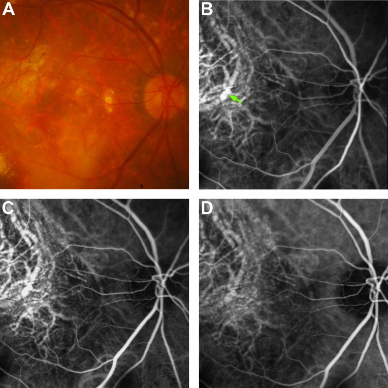 Fig. 4