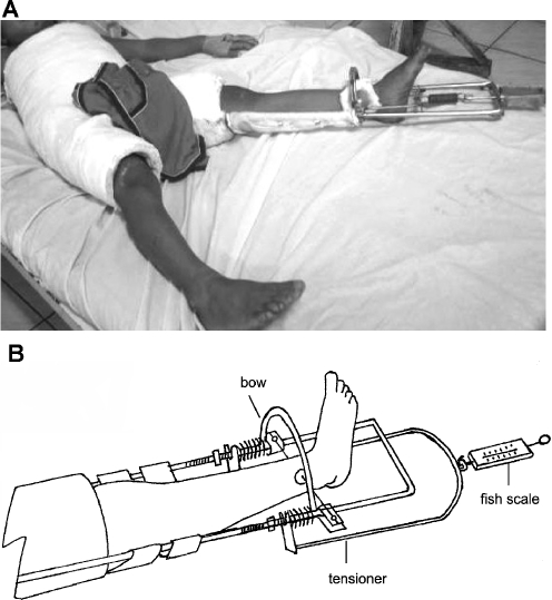 Fig. 2