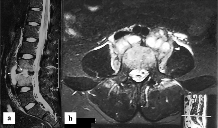 Fig. 13