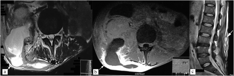 Fig. 11