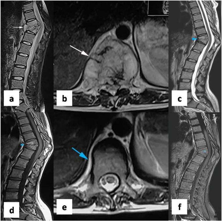 Fig. 15