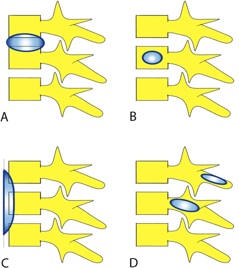 Fig. 1