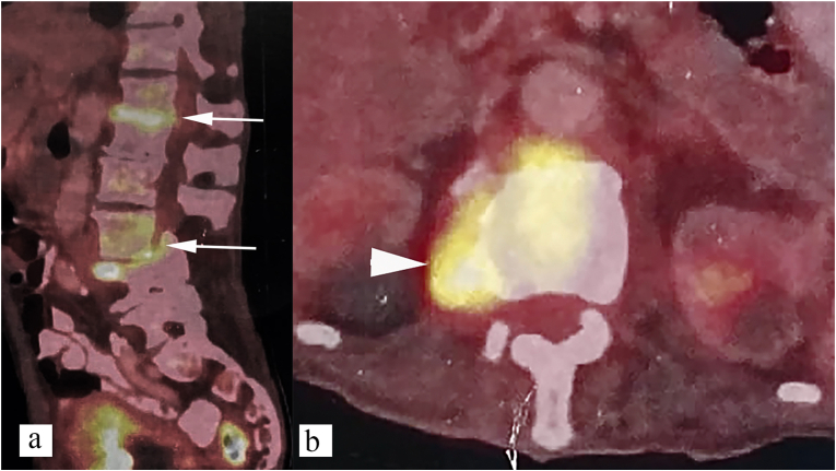 Fig. 12