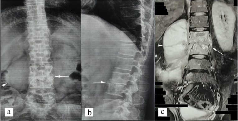 Fig. 3