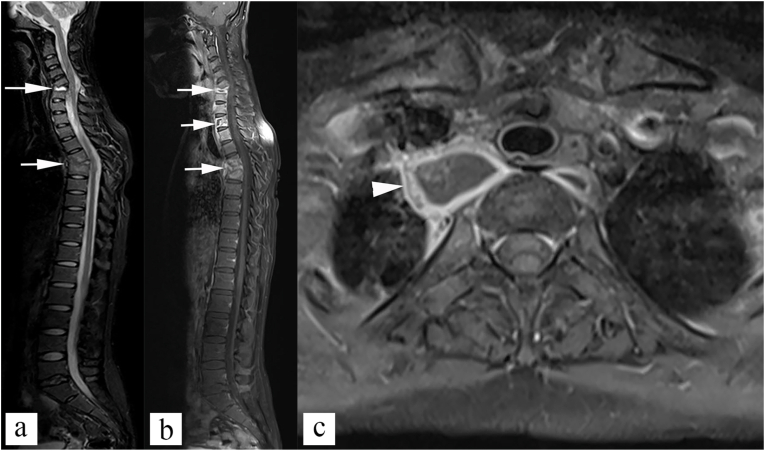 Fig. 10