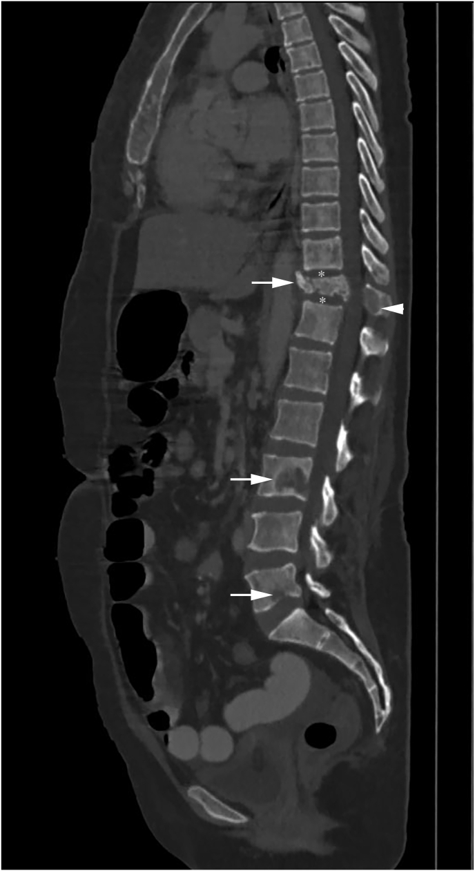 Fig. 14