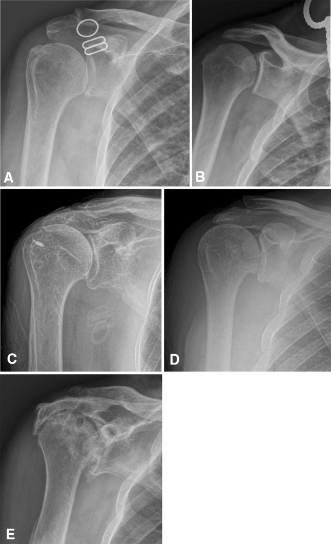 Fig. 2A–E