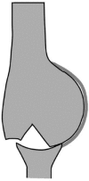 Fig. 12