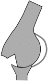 Fig. 11