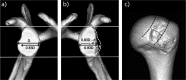 Fig. 18