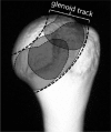 Fig. 17