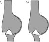 Fig. 14