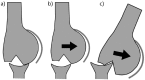 Fig. 15