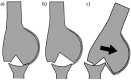 Fig. 16