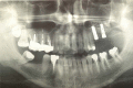 Fig. (6)