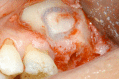 Fig. (1)