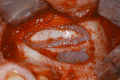 Fig. (4)