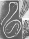 95