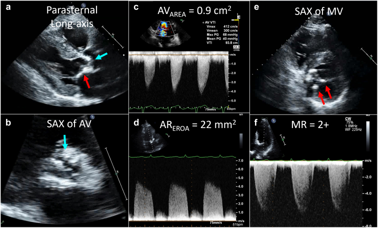 Figure 2