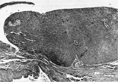 FIGURE 6 Bottom