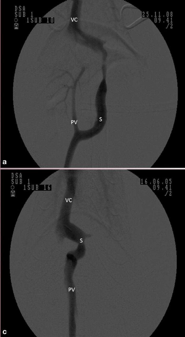 graphic file with name 10.1016_j.jfms.2011.01.010-fig11.jpg