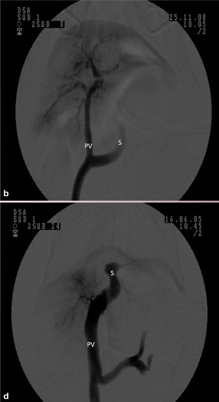 graphic file with name 10.1016_j.jfms.2011.01.010-fig12.jpg