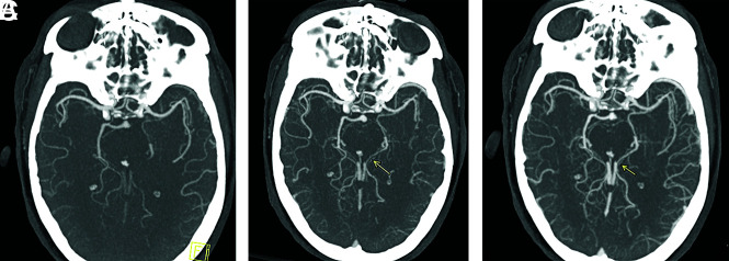 FIG 2.