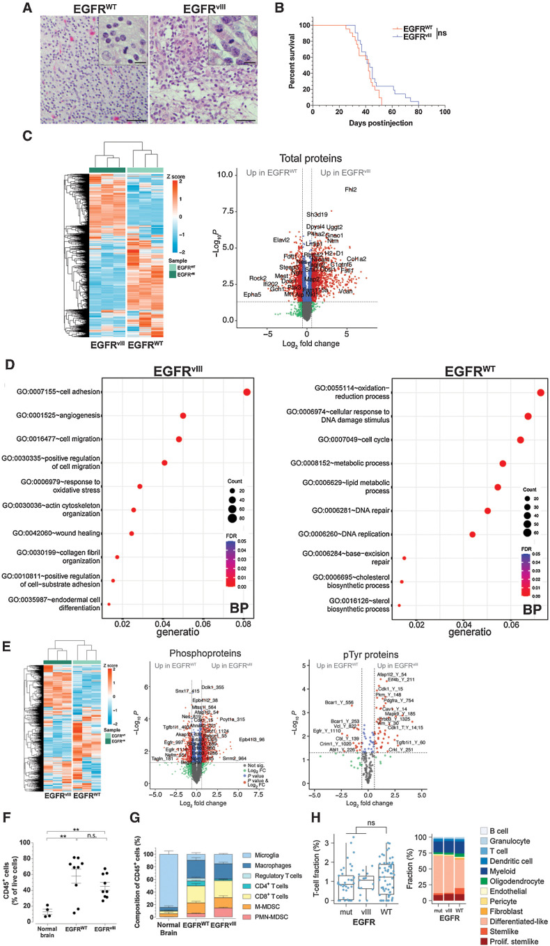 Figure 1. Distinctive histopathological, signaling and immune characteristics of EGFRvIII and EGFR-WT GBMs. A, Representative H&E sections of mouse GBMs. Scale bar = 50 μm; inset = 10 μm. B, Kaplan–Meier analysis of GBM mice. P = 0.1118; n.s., not significant, log-rank (Mantel–Cox), n = 21 each EGFR-WT and EGFRvIII. C, Unsupervised clustering heat map and volcano plot of quantitative proteomics from EGFR-WT and EGFRvIII GBM-derived cells. n = 3 from biological replicates for each line. D, GO analysis of significantly upregulated proteins in EGFR-WT and EGFRvIII GBM cells. BP, biological processes. E, Unsupervised clustering heat map and volcano plots of quantitative phosphoproteomics from EGFR-WT and EGFRvIII GBM-derived cells. n = 3 from biological replicates for each line. F, Flow cytometry of CD45+ cells in normal brain (n = 4), EGFR-WT (n = 9), and EGFRvIII (n = 9) GBMs. G, Flow cytometry of immune cells in normal brain (n = 4), EGFR-WT (n = 10), and EGFRvIII (n = 9) GBMs. H, CIBERSORTx cell state fraction deconvolution analysis performed on human TCGA glioma RNA-seq dataset from EGFR-WT (n = 62), EGFRvIII (n = 15), and mutated EGFR (mut) other than vIII (n = 41). Left, plot of T-cell fraction as percent of all cells, right panel, stacked percent fraction of all immune cells determined by CIBERSORTx. Mean ± SEM of biological replicates. **, P < 0.01; ns; not significant, unpaired t test, two-tailed (F, G).