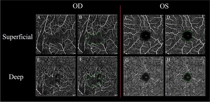 Fig. 2