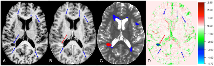 Fig 1