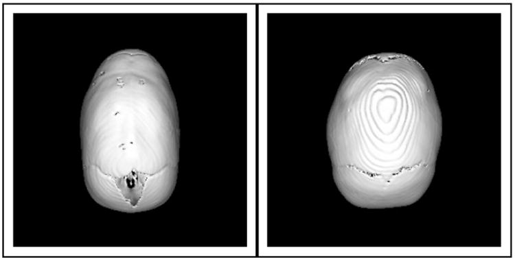 Fig. 10