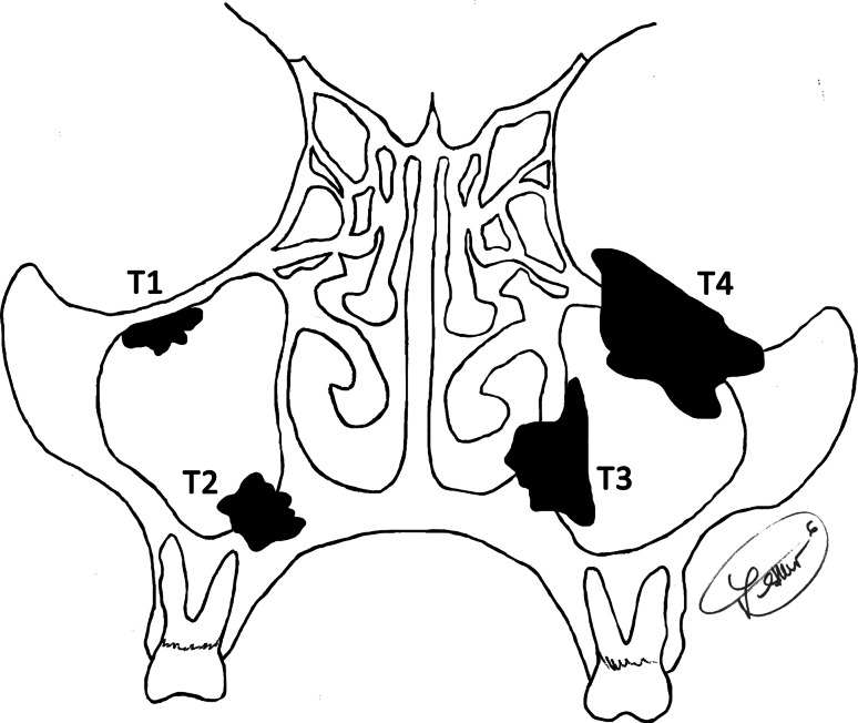 Fig. 1