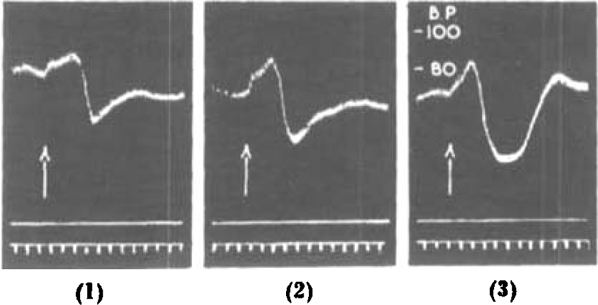 Fig. 16