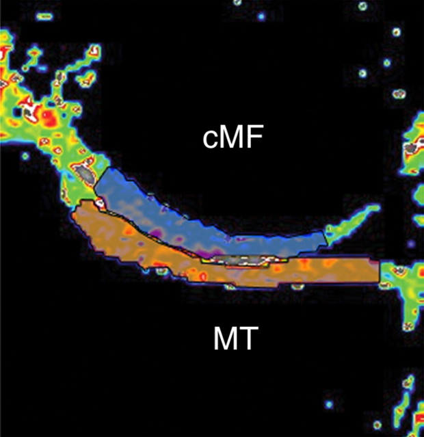 Figure 2b: