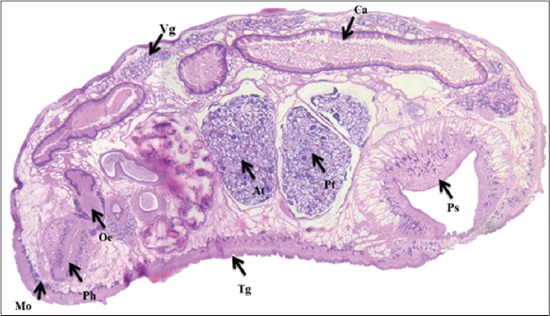 Figure-3