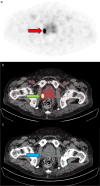 Fig. 1
