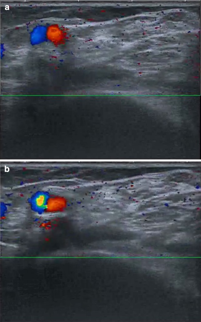 Fig. 3