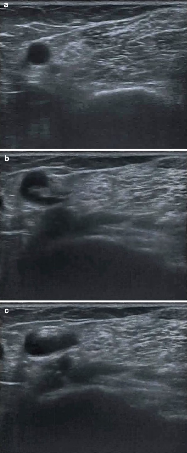 Fig. 2