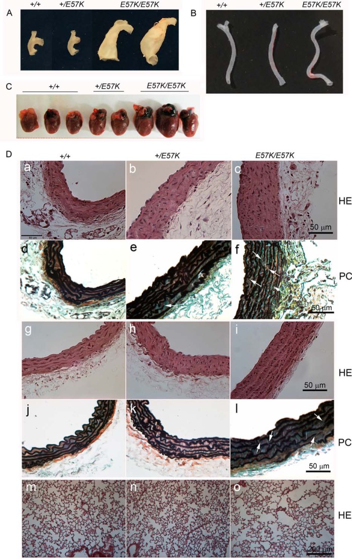 FIGURE 11.